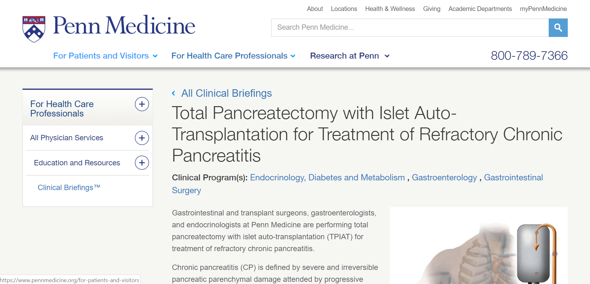 Penn Medicine, Total Pancreatectomy with Islet Auto-Transplantation for Treatment of Refractory Pancreatitis, Clinical Program for Diabetes